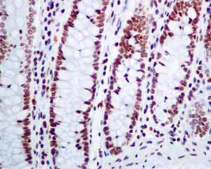 IHC of paraffin-embedded human colon tissue using anti-CLP1 antibody.