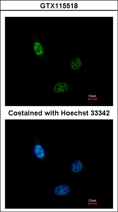 Immunofluorescence of paraformaldehyde-fixed HeLa using CLP1 antibody at 1:200 dilution.