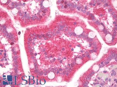 Anti-CHM / REP1 antibody IHC staining of human small intestine. Immunohistochemistry of formalin-fixed, paraffin-embedded tissue after heat-induced antigen retrieval.