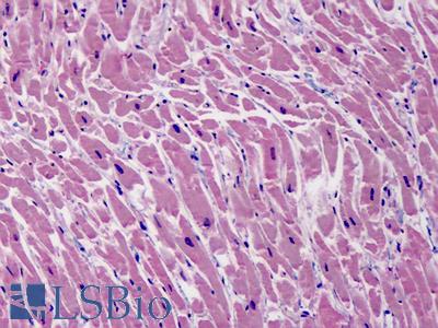 Anti-EGLN1 / PHD2 antibody IHC of human heart. Immunohistochemistry of formalin-fixed, paraffin-embedded tissue after heat-induced antigen retrieval. Antibody LS-B4810 concentration 5 ug/ml.