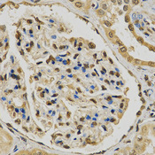 Immunohistochemistry of paraffin-embedded human kidney using EGLN1 antibody at dilution of 1:200 (x400 lens).