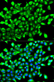Immunofluorescence analysis of MCF-7 cell using EGLN1 antibody. Blue: DAPI for nuclear staining.