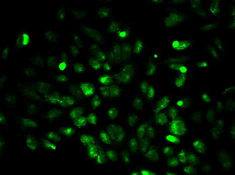 Immunofluorescence analysis of MCF-7 cell using EGLN1 antibody. Blue: DAPI for nuclear staining.
