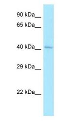 CLP1 antibody Western Blot of HepG2 cell lysate. CLP1 is supported by BioGPS gene expression data to be expressed in HepG2.