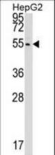 CLP1 Antibody western blot of HepG2 cell line lysates (35 ug/lane). The CLP1 antibody detected the CLP1 protein (arrow).