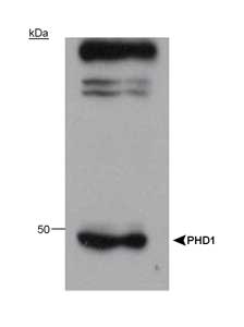 Western blot of human PHD1