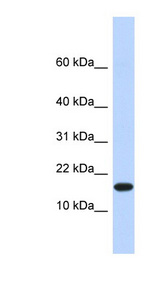 EGLN2 / PHD1 antibody LS-C101515 Western blot of Fetal Heart lysate.