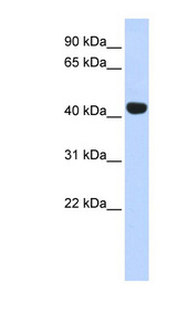 EGLN2 / PHD1 antibody LS-C110437 Western blot of Fetal Muscle lysate.