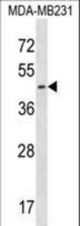 EGLN2 Antibody western blot of MDA-MB231 cell line lysates (35 ug/lane). The EGLN2 antibody detected the EGLN2 protein (arrow).