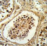 Formalin-fixed and paraffin-embedded human testis tissue reacted with EGLN2 Antibody , which was peroxidase-conjugated to the secondary antibody, followed by DAB staining. This data demonstrates the use of this antibody for immunohistochemistry; clinical relevance has not been evaluated.