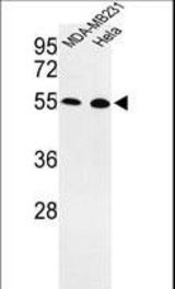 Western blot of EGLN2 Antibody in MDA-MB231, HeLa cell line lysates (35 ug/lane). EGLN2 (arrow) was detected using the purified antibody.