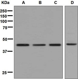 Western blot analysis on (A) HeLa, (B) HepG2, (C) 293T, and (D) Jurkat cell lysates using anti-CLP1 antibody.