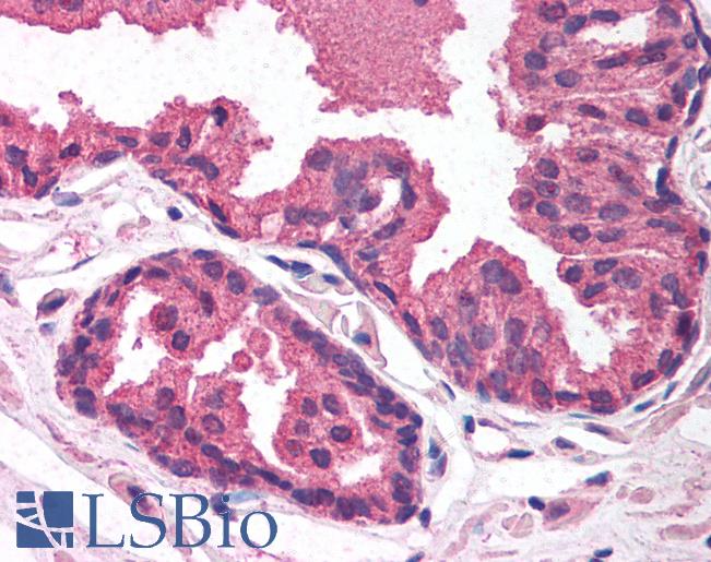 Anti-EGLN2 / PHD1 antibody IHC of human prostate. Immunohistochemistry of formalin-fixed, paraffin-embedded tissue after heat-induced antigen retrieval. Antibody LS-B1524 concentration 5 ug/ml.