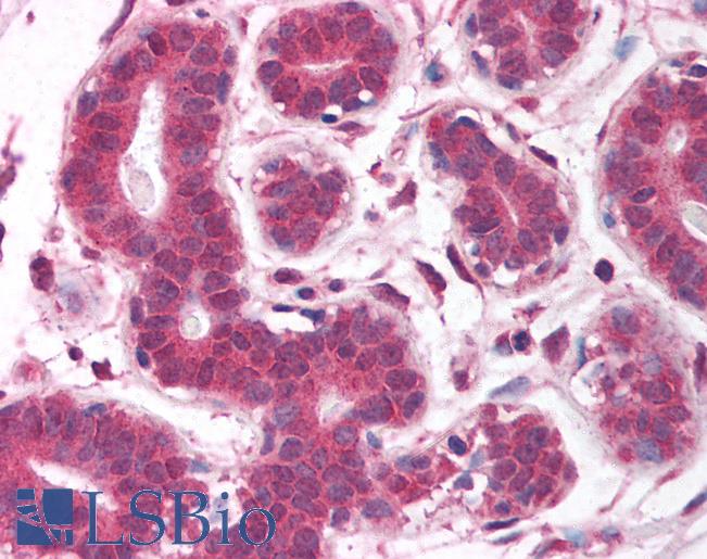 Anti-EGLN2 / PHD1 antibody IHC of human breast. Immunohistochemistry of formalin-fixed, paraffin-embedded tissue after heat-induced antigen retrieval. Antibody LS-B1524 concentration 5 ug/ml.