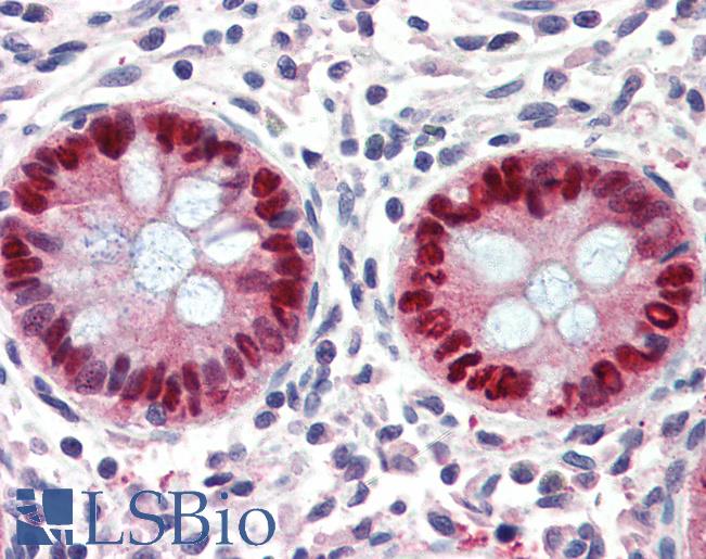 Anti-EGR2 antibody IHC of human colon. Immunohistochemistry of formalin-fixed, paraffin-embedded tissue after heat-induced antigen retrieval. Antibody LS-B3255 concentration 75 ug/ml.