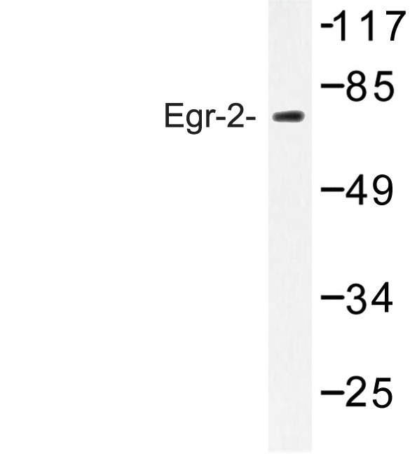Western blot of Egr-2 (R409) pAb in extracts from HUVEC cells.