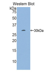 Western blot of recombinant EGR2.