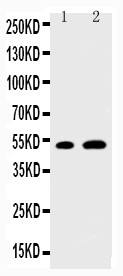 WB of EGR2 antibody. Lane 1: NIH3T3 Cell Lysate. Lane 2: MCF-7 Cell Lysate.