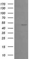 HEK293T cells were transfected with the pCMV6-ENTRY control (Left lane) or pCMV6-ENTRY EGR2 (Right lane) cDNA for 48 hrs and lysed. Equivalent amounts of cell lysates (5 ug per lane) were separated by SDS-PAGE and immunoblotted with anti-EGR2.
