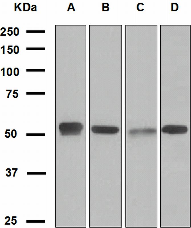 Western blot analysis on (A) LnCaP, (B) HepG2, (C) MCF-7, and (D) SH-SY5Y cell lysates using anti-EGR2 antibody.
