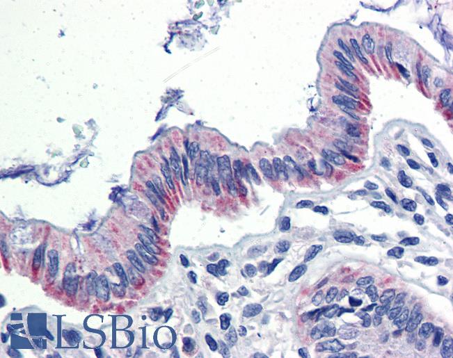 Anti-EGR2 antibody IHC of human colon. Immunohistochemistry of formalin-fixed, paraffin-embedded tissue after heat-induced antigen retrieval. Antibody LS-B3577 concentration 5 ug/ml.