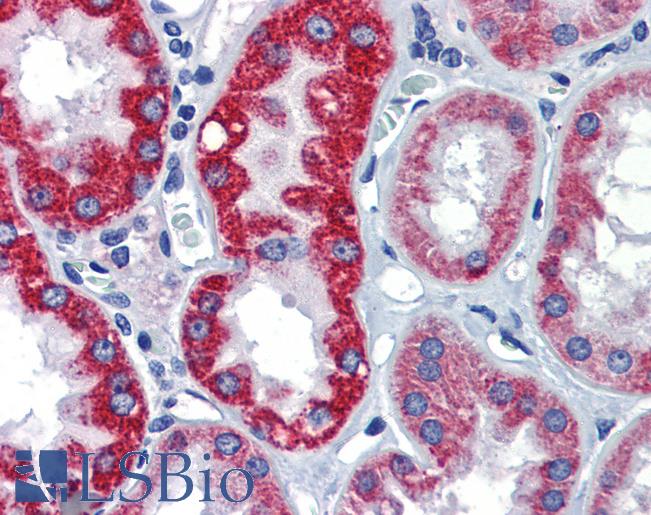 Anti-EGR2 antibody IHC of human kidney. Immunohistochemistry of formalin-fixed, paraffin-embedded tissue after heat-induced antigen retrieval. Antibody LS-B3577 concentration 5 ug/ml.