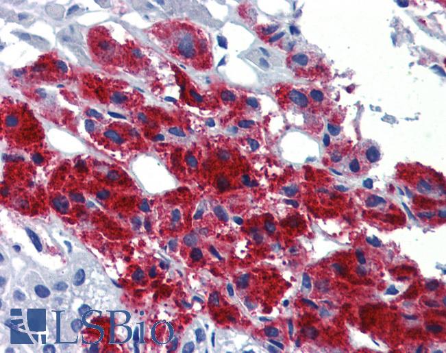 Anti-EGR2 antibody IHC of human adrenal. Immunohistochemistry of formalin-fixed, paraffin-embedded tissue after heat-induced antigen retrieval. Antibody LS-B3577 concentration 5 ug/ml.