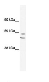Fetal Lung Lysate.
