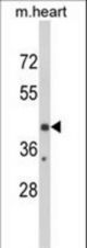 Western blot of EGR3 Antibody in mouse heart tissue lysates (35 ug/lane). EGR3 (arrow) was detected using the purified antibody.