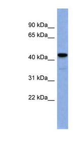 EGR3 antibody LS-B6617 Western blot of Fetal Spleen lysate.