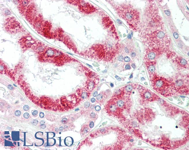Anti-CLPB antibody IHC staining of human kidney. Immunohistochemistry of formalin-fixed, paraffin-embedded tissue after heat-induced antigen retrieval. Antibody LS-B9751 concentration 20 ug/ml.