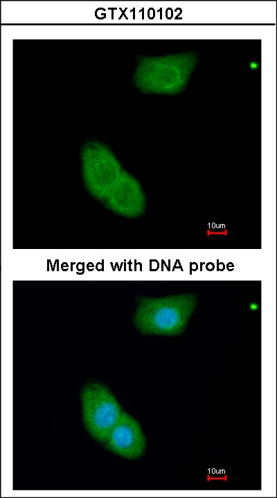 Immunofluorescence of paraformaldehyde-fixed A549 using EHBP1 antibody at 1:200 dilution.