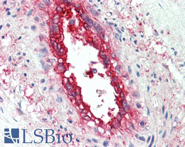Anti-EHD2 antibody IHC staining of human vessel. Immunohistochemistry of formalin-fixed, paraffin-embedded tissue after heat-induced antigen retrieval. Antibody LS-B10279 concentration 5 ug/ml.