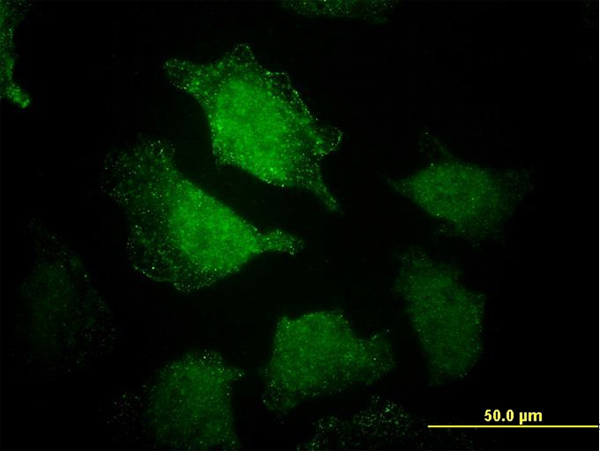 Immunofluorescence of monoclonal antibody to EHD3 on HeLa cell. [antibody concentration 25 ug/ml]