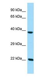 CLPP antibody Western Blot of 293T.
