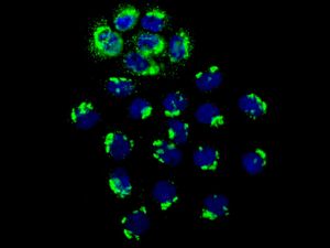 Immunofluorescent staining of A431 cells using anti-CHM antibody.