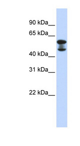 EHD4 antibody LS-C111651 Western blot of Fetal Lung lysate.