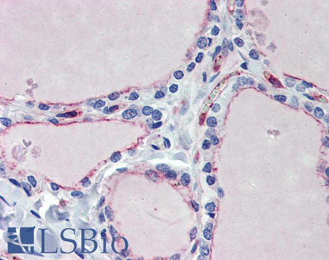 Anti-EHD4 antibody IHC of human thyroid. Immunohistochemistry of formalin-fixed, paraffin-embedded tissue after heat-induced antigen retrieval. Antibody LS-B4022 concentration 5 ug/ml.