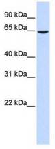 Western analysis of fetal lung lysate.