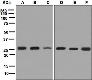 Western blot analysis on (A) fetal muscle, (B) Saos-2, (C) A431, (D) 293T, (E) K562, and (F) A549 lysates using anti-CLPP antibody.