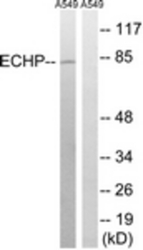 Western blot of extracts from A549 cells, using EHHADH Antibody. The lane on the right is treated with the synthesized peptide.