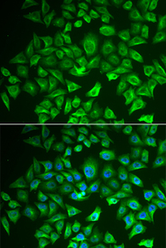 Immunofluorescence analysis of A549 cell using EHHADH antibody. Blue: DAPI for nuclear staining.