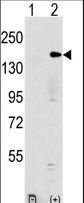 Western blot of EHMT1 (arrow) using rabbit polyclonal EHMT1 Antibody. 293 cell lysates (2 ug/lane) either nontransfected (Lane 1) or transiently transfected with the EHMT1 gene (Lane 2) (Origene Technologies).