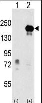 Western blot of EHMT1 (arrow) using rabbit polyclonal EHMT1 Antibody. 293 cell lysates (2 ug/lane) either nontransfected (Lane 1) or transiently transfected with the EHMT1 gene (Lane 2) (Origene Technologies).