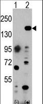 Western blot of EHMT1 (arrow) using rabbit polyclonal EHMT1 Antibody. 293 cell lysates (2 ug/lane) either nontransfected (Lane 1) or transiently transfected with the EHMT1 gene (Lane 2) (Origene Technologies).