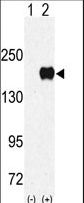Western blot of EUHMTASE (arrow) using rabbit polyclonal EHMT1 (EUHMTASE1) Antibody. 293 cell lysates (2 ug/lane) either nontransfected (Lane 1) or transiently transfected with the EUHMTASE gene (Lane 2) (Origene Technologies).