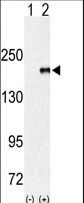Western blot of EUHMTASE (arrow) using rabbit polyclonal EHMT1 (EUHMTASE1) Antibody. 293 cell lysates (2 ug/lane) either nontransfected (Lane 1) or transiently transfected with the EUHMTASE gene (Lane 2) (Origene Technologies).