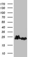 HEK293T cells were transfected with the pCMV6-ENTRY control (Left lane) or pCMV6-ENTRY EIF1AY (Right lane) cDNA for 48 hrs and lysed. Equivalent amounts of cell lysates (5 ug per lane) were separated by SDS-PAGE and immunoblotted with anti-EIF1AY.