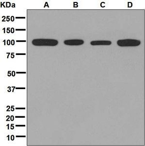 Western blot analysis on (A) HeLa, (B) Y79, (C) A431, and (D) 293T cell lysates using anti-CHM antibody.
