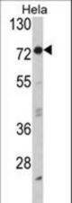 Western blot of EIF2AK1 Antibody in HeLa cell line lysates (35 ug/lane). EIF2AK1 (arrow) was detected using the purified antibody.